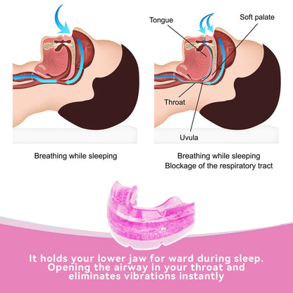 Anti Snore Bruxism Mouth Guard Stop Snoring Mouthpiece Teeth Bruxism Sleeping Aid Apnea Devices Night Anti-Snoring Mouth Guard